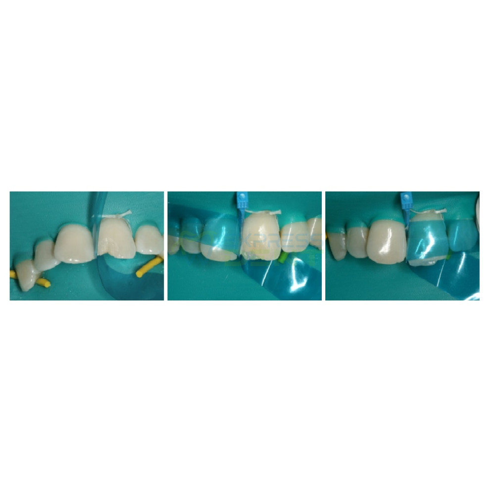 Гаррісон матриця Garrison Blue View VariStrip, прозора, 1шт.