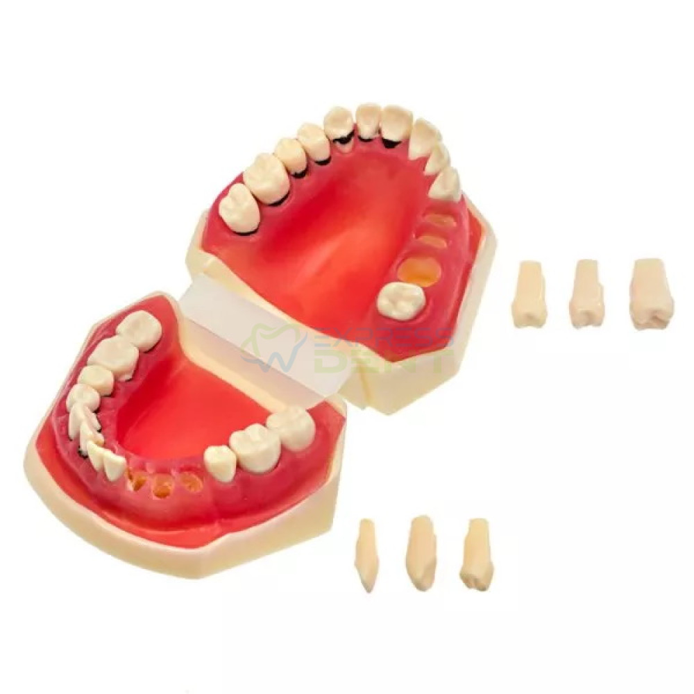 Модель демонстраційна навчальна пародонтологічна